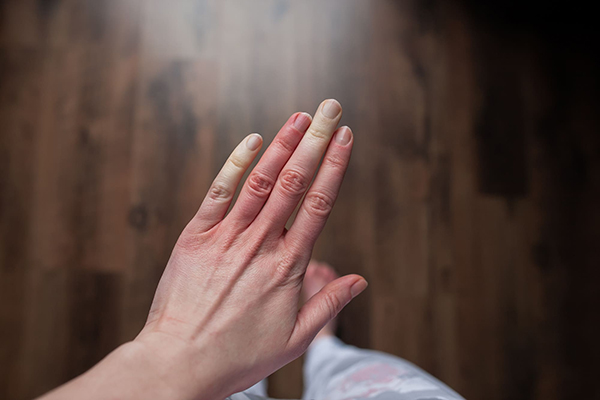 raynaud
